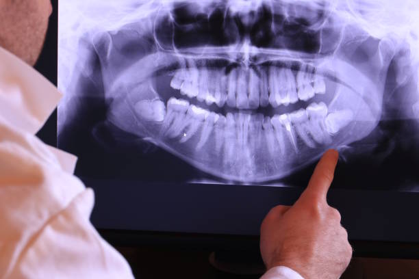 Best Emergency Root Canal Treatment in Millersburg, OR