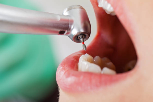 Best Pediatric Emergency Dentist in Millersburg, OR
